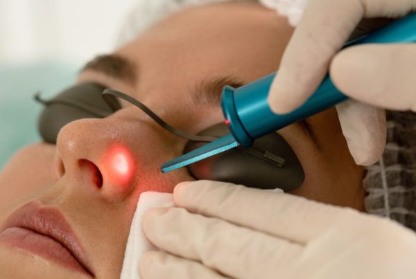 Recovery Tips After Laser for Pigmentation | Enhanze Clinic