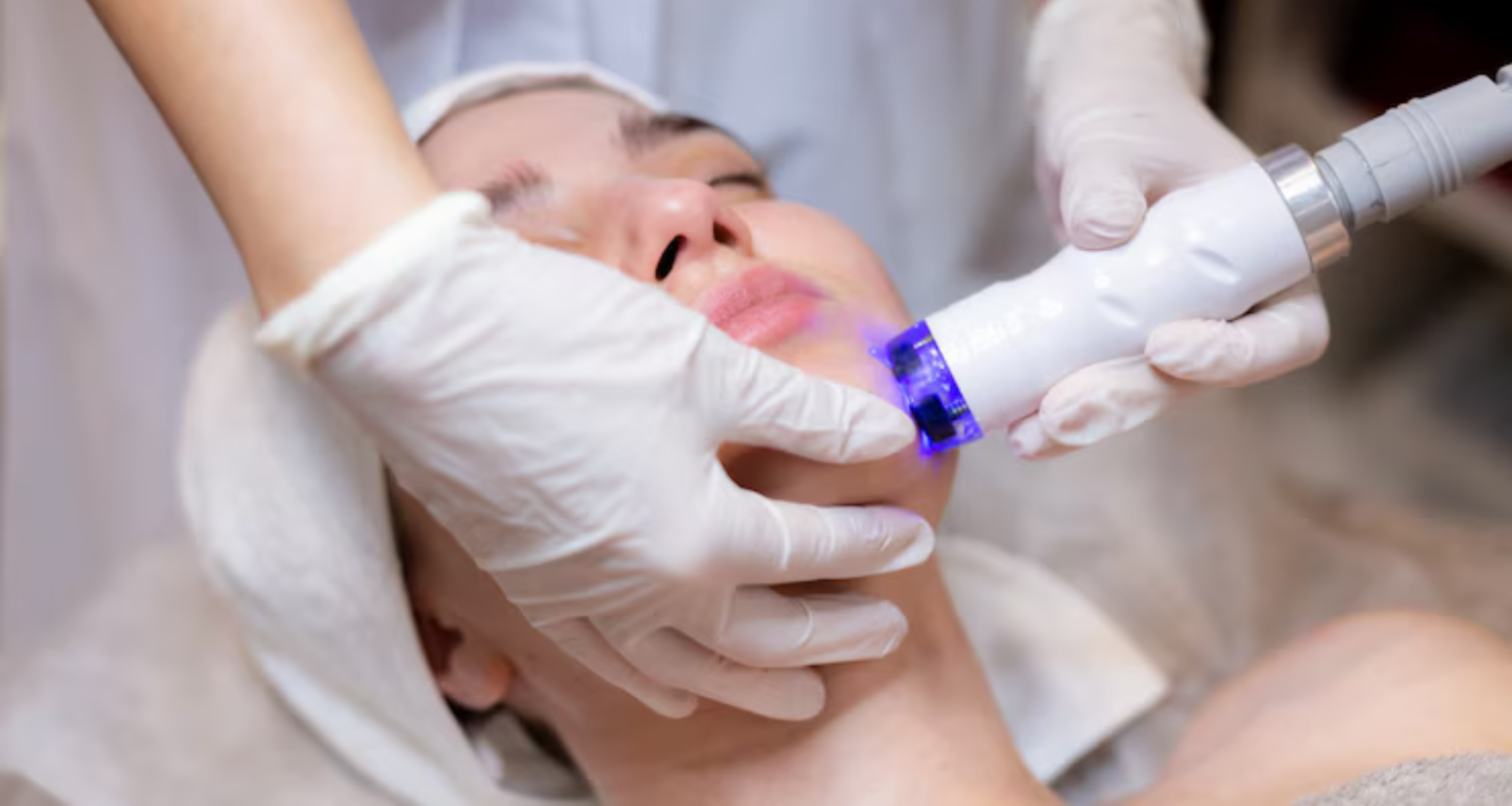 Fractional CO2 Laser