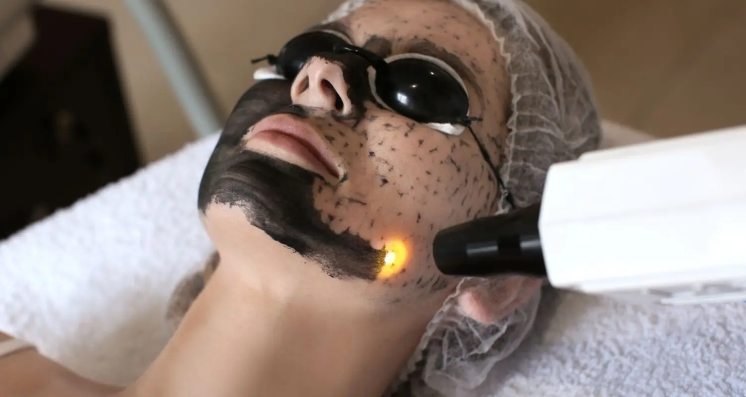 Parut Jerawat: Laser Fractional Atau Pico?