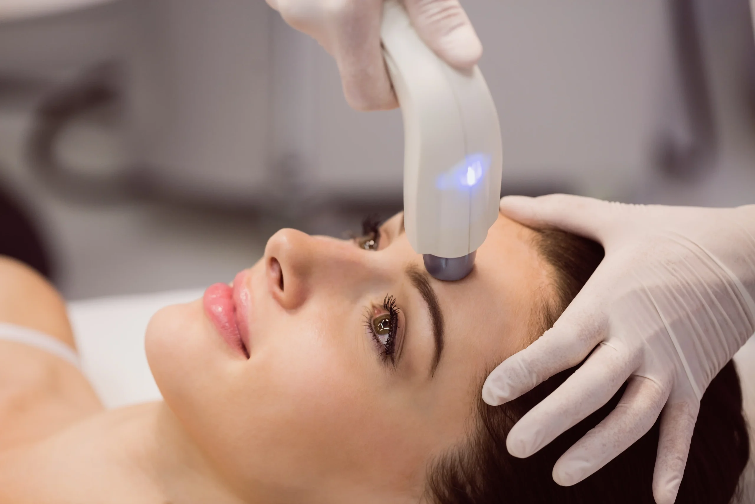 Laser for Pigmentation Removal Processes