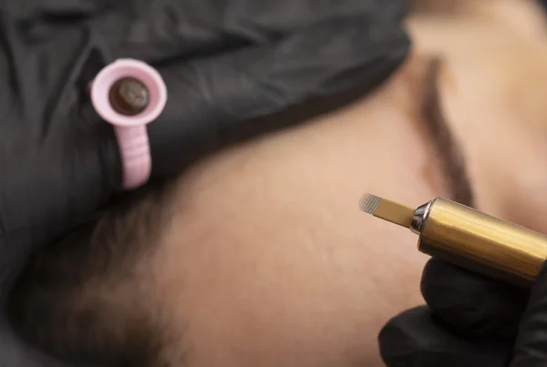 microneedling near me