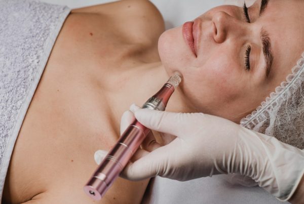 microneedling near me