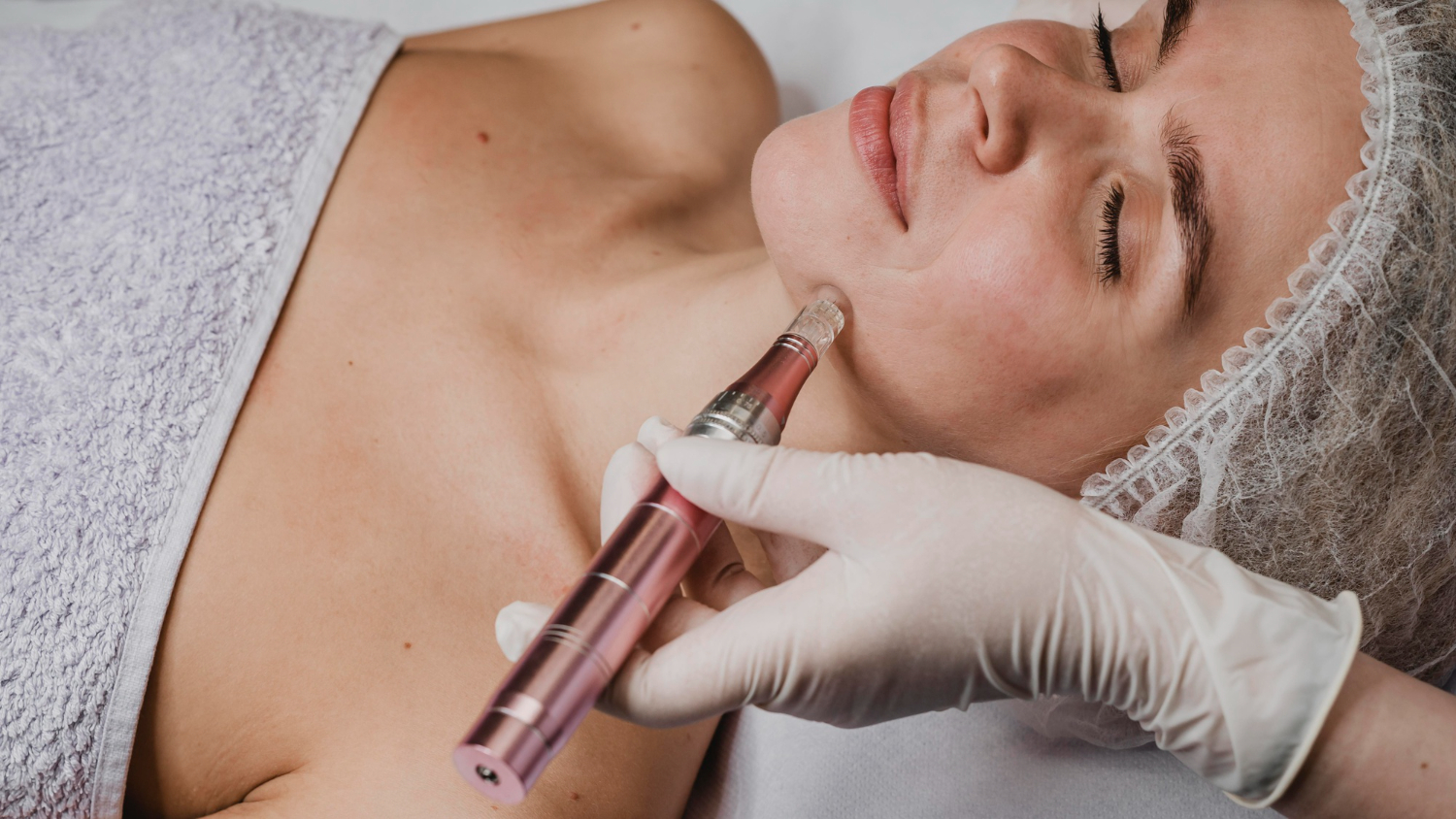 microneedling near me