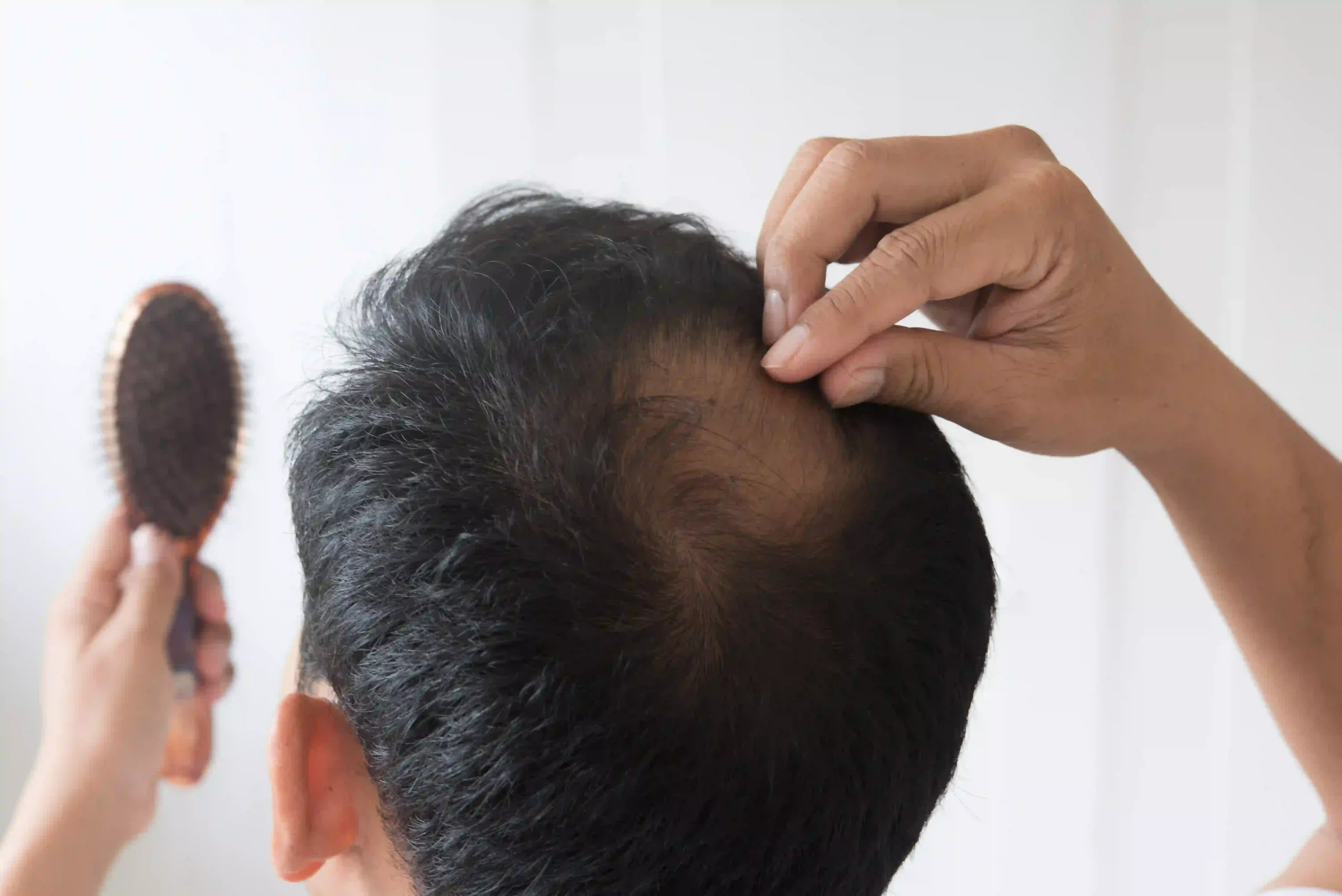 Hair Loss Treatment Near Me: What to Expect After Care
